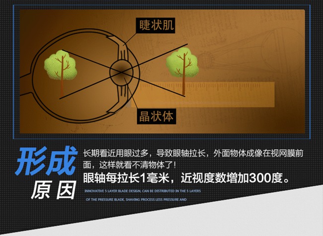 眼轴控制仪